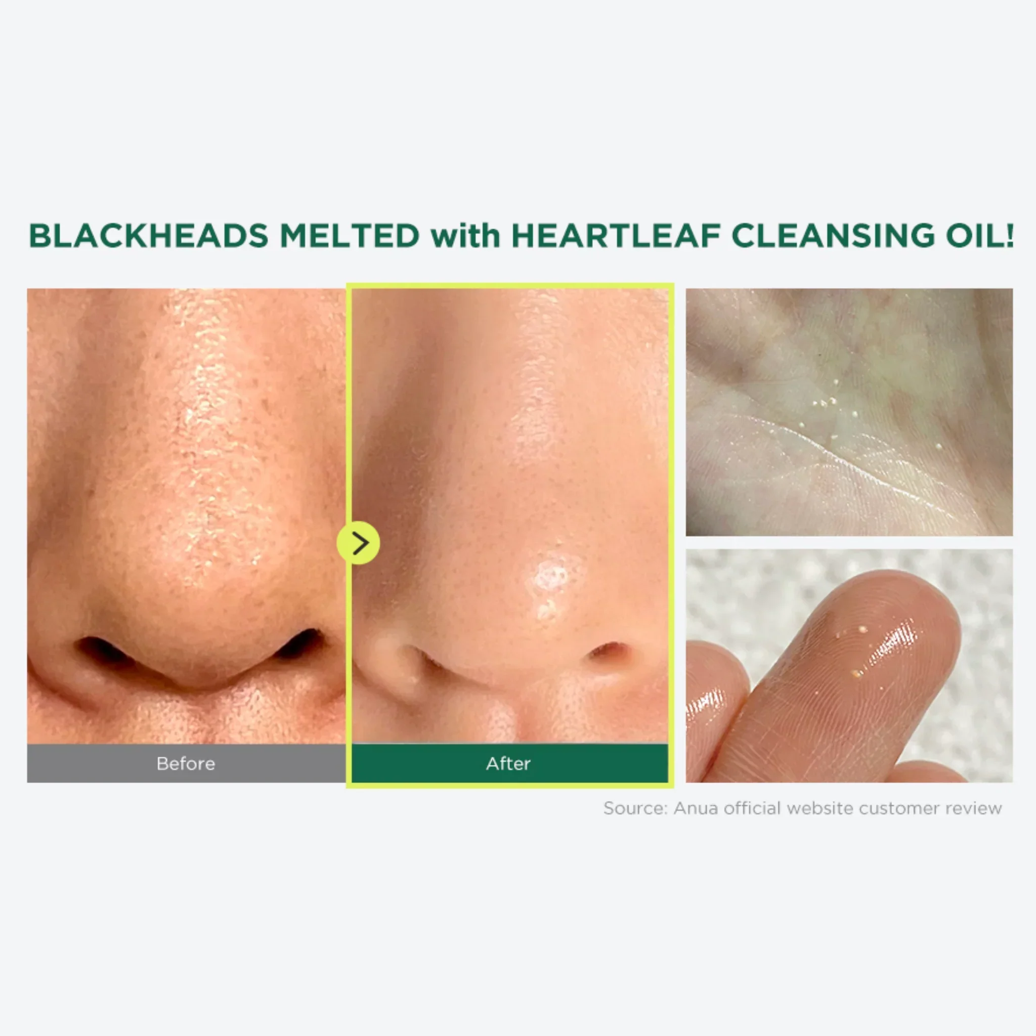 Anua Heartleaf Pore Control Cleansing Oil - Image 8