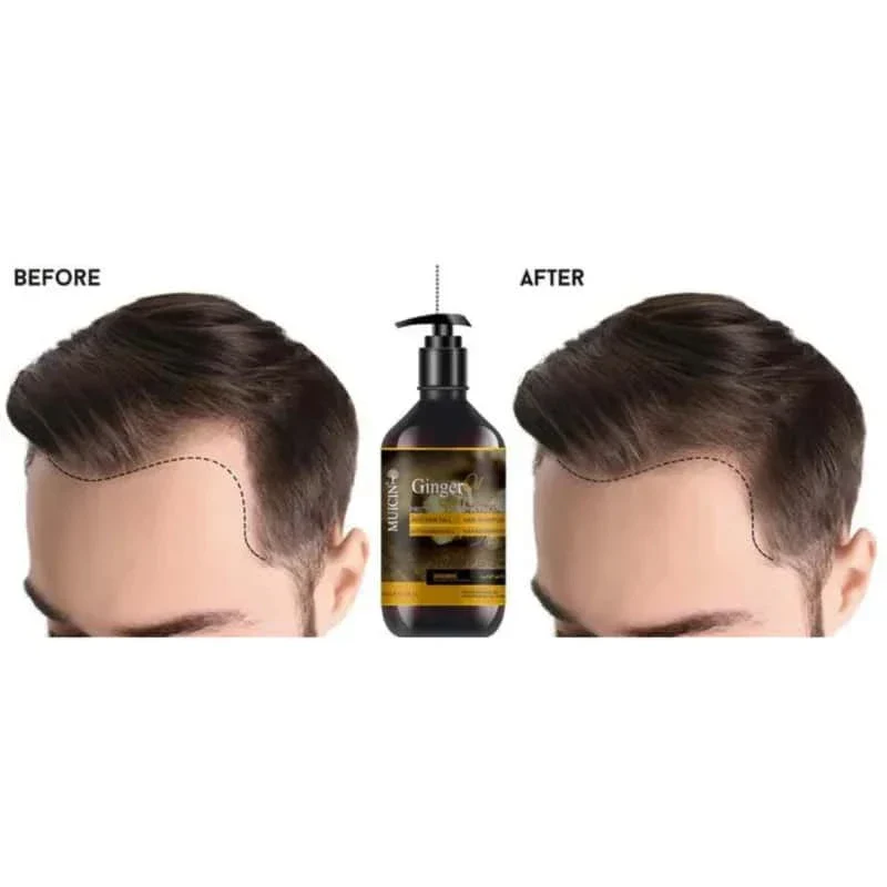 Muicin-Ginger Oil Anti-Hair Fall Shampoo - Image 3
