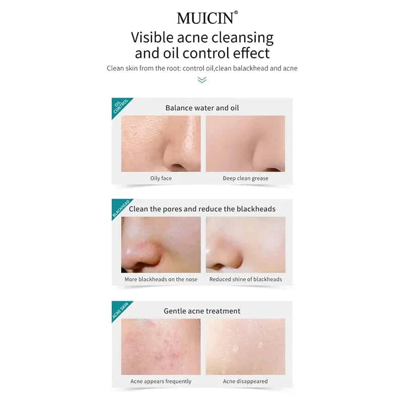 Muicin-Tea Tree Bubble Foaming Facial Cleanser - Image 8