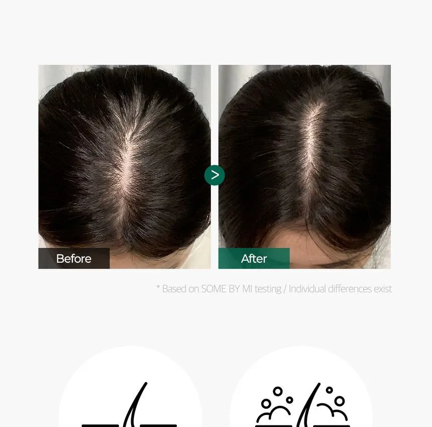 Some By Mi Miracle Hair & Body Starter Kit - Image 2